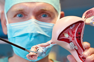 Demonstration Eileiterentfernung an Modell