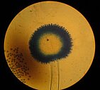 Fruchtstand des Aspergillus Fruchtstand des Aspergillus