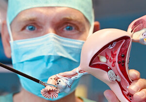 Demonstration Eileiterentfernung an Modell