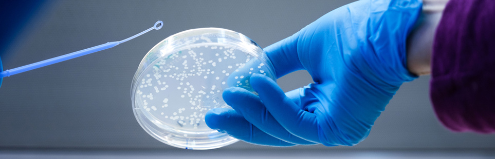 Eine Hand mit blauem Handschuh hält eine Petritschale, in der kleine Punkte zu sehen sind, von der anderen Seite wird eine Eine Impföse mit einem kleinen, kreisförmigen Spitze zur Petrischale geführt 